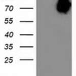 ASNS (Asparagine synthetase) monoclonal antibody