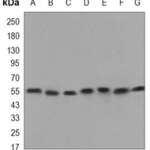 Beclin-1 monoclonal antibody