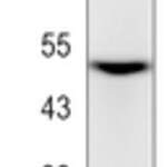 Vimentin (Phospho-S56) Rabbit monoclonal antibody
