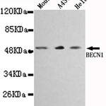 BECN1 Monoclonal Antibody #27117