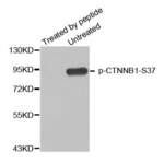 Anti Phospho CTNNB1 S37 Antibody