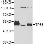 TP53 Monoclonal Antibody