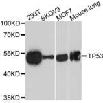 Anti TP53 Antibody
