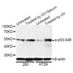 TP53 (pS46) Antibody
