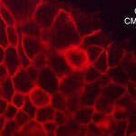 CD44 (Extracellular region) M007 Antibody