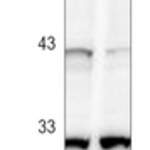 Caspase 3 Rabbit monoclonal antibody