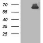 ASNS (Asparagine synthetase) monoclonal antibody