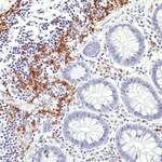 Anti-CD19 Rabbit Monoclonal Antibody, Clone RM332