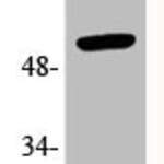 Phospho-TP53 (T18) Antibody