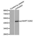 MAPT (pS262) Antibody