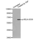 RELA (pS536) Antibody