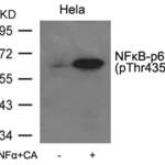 Phospho-RELA (Thr435) Antibody