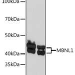 MBNL1 Recombinant Rabbit Monoclonal Antibody (ARC1199)