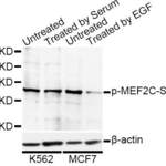 Anti Phospho MEF2C S396 Antibody