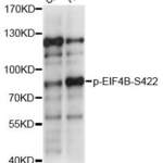 Anti Phospho EIF4B S422 Antibody