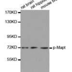 Anti Phospho Mapt S416 Antibody