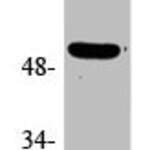 Phospho-TP53 (S15) Antibody