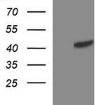 TXNDC5 monoclonal antibody