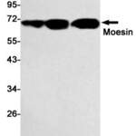 Recombinant Moesin Monoclonal Antibody