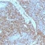 Recombinant CD44 Antibody [clone HCAM/2875R] (V7500)