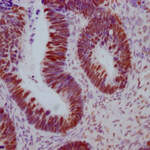 ESR1 Monoclonal Antibody