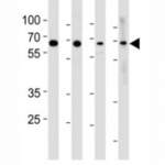 p65 Antibody (RELA) (F49893)