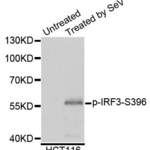 Anti Phospho IRF3 S396 Antibody