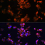 LXR alpha Recombinant Rabbit Monoclonal Antibody (7Z4H10)