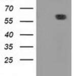 DTNA (Dystrobrevin alpha) monoclonal antibody