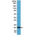 CD3 epsilon Antibody [clone RM344] (R20366)