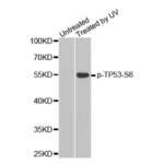 TP53 (pS6) Antibody