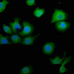 MTMR9 Antibody