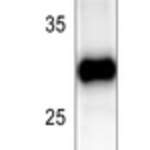 Anti-BCL2 Antibody