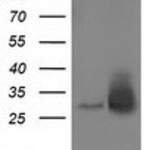 RASD2 monoclonal antibody