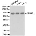 beta Catenin (CTNNB1) Antibody