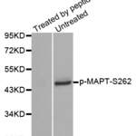 MAPT Antibody (Phospho-Ser262) (OAAN03031)
