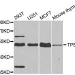 TP53 Polyclonal Antibody