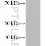 ZFP36 Monoclonal antibody