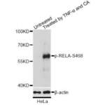 RELA (pS468) Antibody