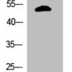 Phospho-TP53 (S366) Antibody