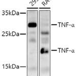 TNF antibody #38122