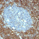 Bcl-2 (Apoptosis & Follicular Lymphoma Marker) Antibody - Without BSA and Azide