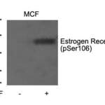Phospho-ESR1 (Ser106) Antibody