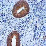 TIMP2 Monoclonal Antibody (OTI1A6), TrueMAB™