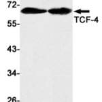 Recombinant Transcription Factor 7 Like 2 Monoclonal Antibody