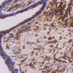 CD44 Recombinant Rabbit Monoclonal Antibody (ST57-03)