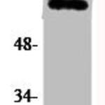 Phospho-RELA (S536) Antibody