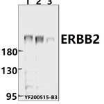 ERBB2 polyclonal antibody