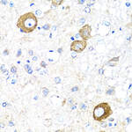 NRG4 Polyclonal Antibody