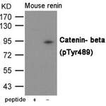 Phospho-CTNNB1 (Tyr489) Antibody